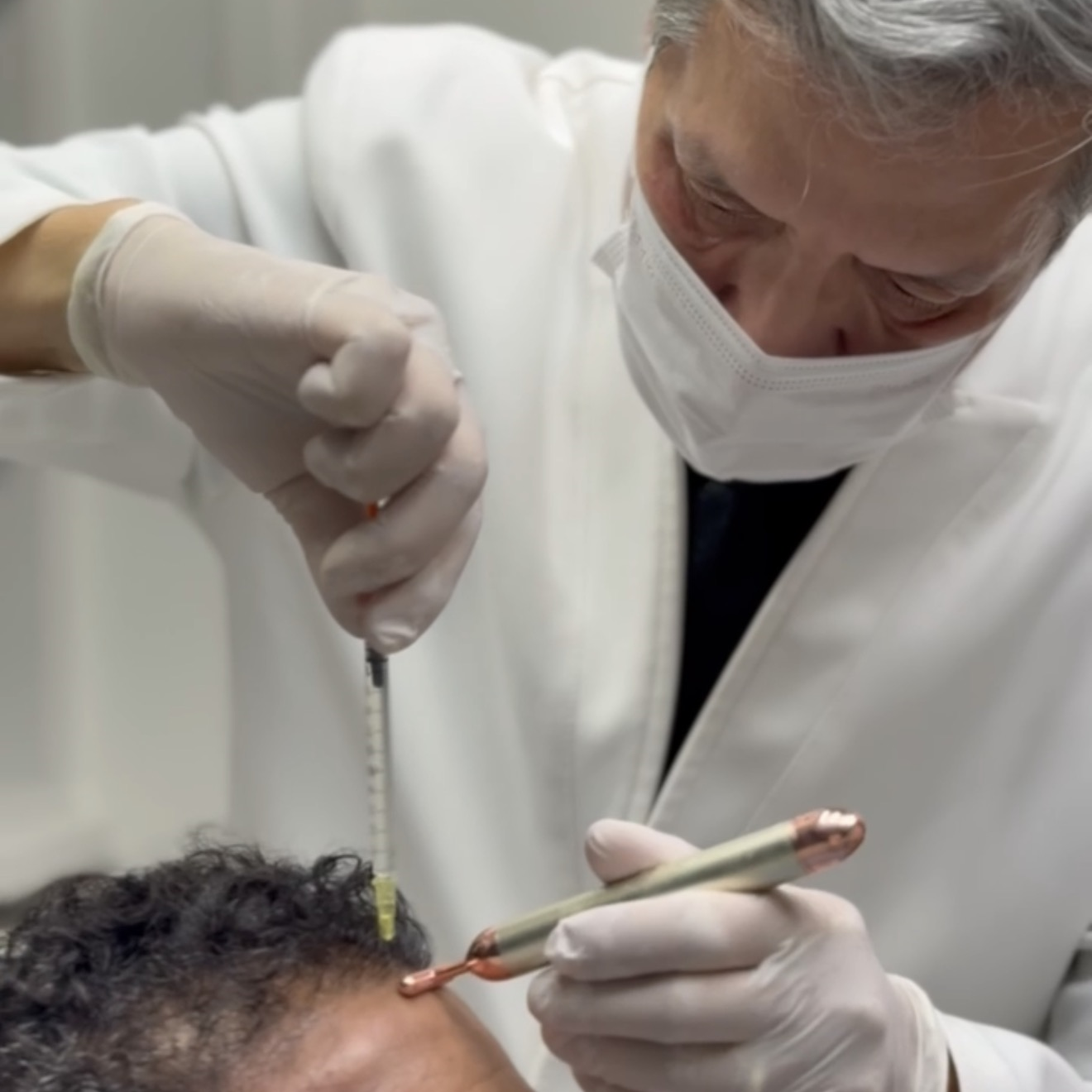 Tratamento da alopecia androgenética: causas, diagnóstico e opções para controlar a queda de cabelo