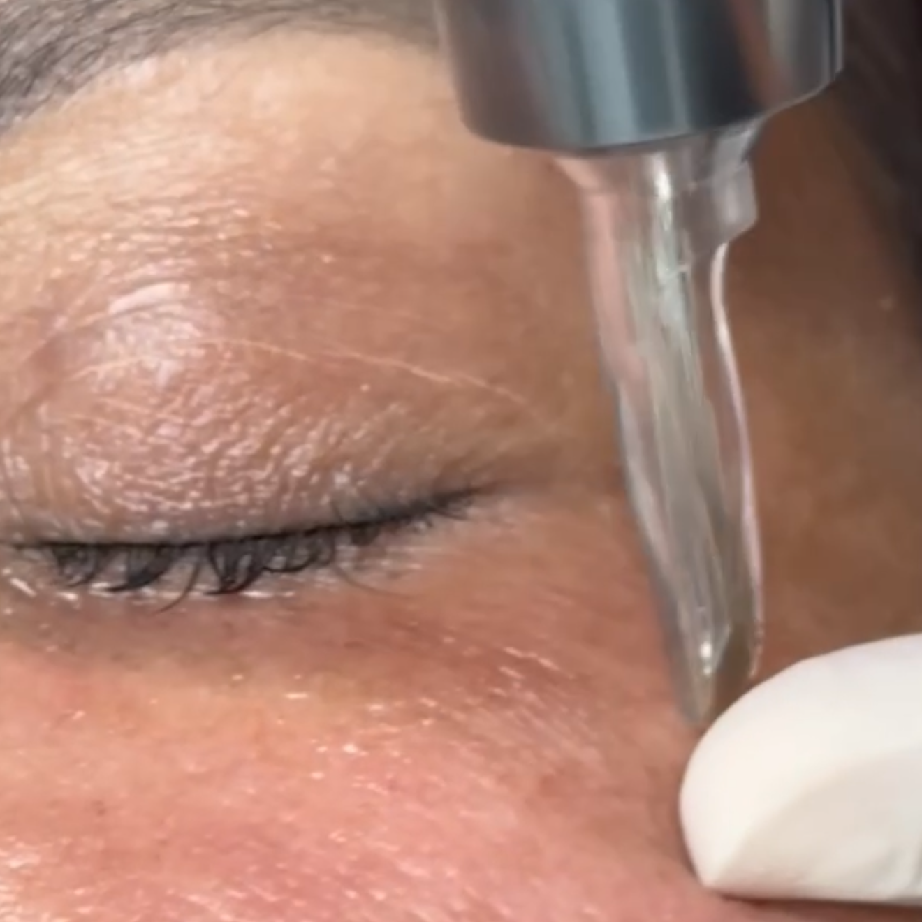 Exossomos na dermatologia: o que a ciência realmente mostra sobre essa tecnologia